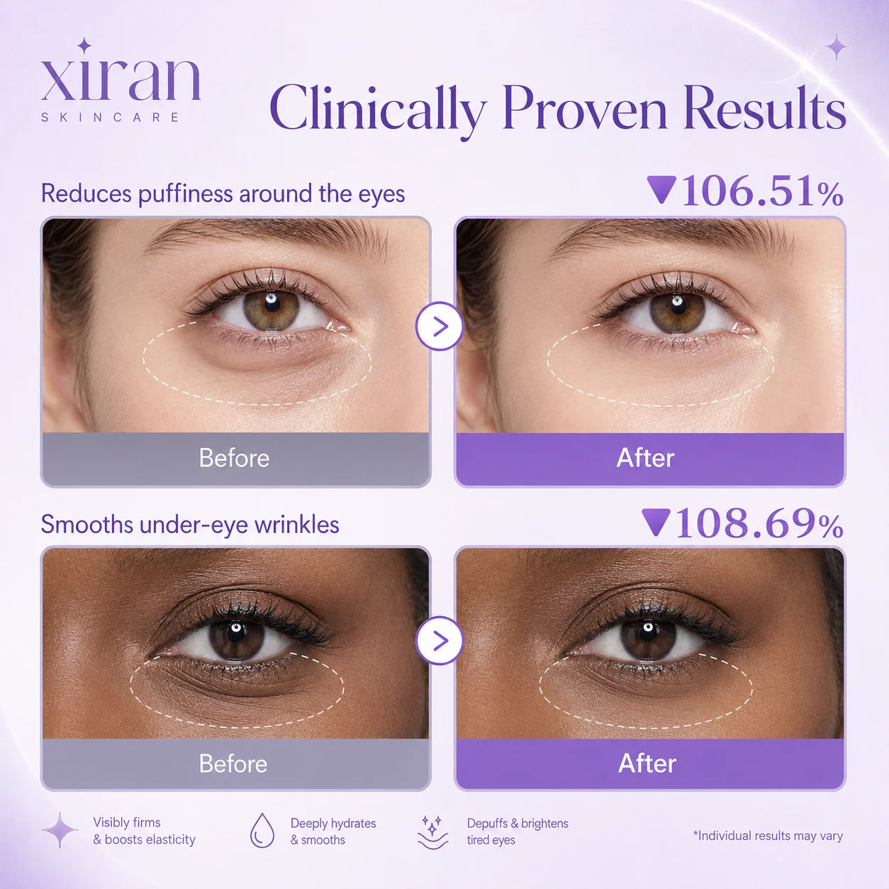 Comparaison des résultats avant et après l'utilisation d'un produit de soin contour des yeux montrant une réduction des poches et un lissage des rides sous les yeux.